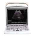 PT405 4D Portable Color Doppler